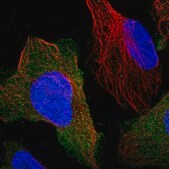 Anti-PPP3R1 antibody produced in rabbit Prestige Antibodies&#174; Powered by Atlas Antibodies, affinity isolated antibody, buffered aqueous glycerol solution