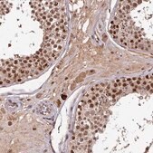 Anti-POLD1 antibody produced in rabbit Prestige Antibodies&#174; Powered by Atlas Antibodies, affinity isolated antibody, buffered aqueous glycerol solution
