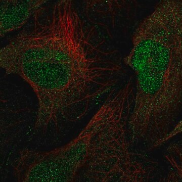 Anti-MAGI1 antibody produced in rabbit Prestige Antibodies&#174; Powered by Atlas Antibodies, affinity isolated antibody