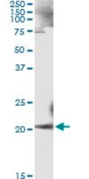 Monoclonal Anti-ANK1 antibody produced in mouse clone 3C3, purified immunoglobulin, buffered aqueous solution