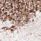 Anti-NTRK1 antibody produced in rabbit Prestige Antibodies&#174; Powered by Atlas Antibodies, affinity isolated antibody, buffered aqueous glycerol solution