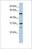 Anti-IMPDH1 antibody produced in rabbit affinity isolated antibody