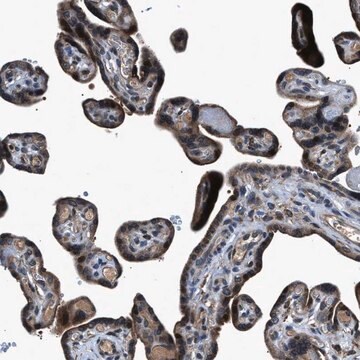 Anti-TNRC18 antibody produced in rabbit Prestige Antibodies&#174; Powered by Atlas Antibodies, affinity isolated antibody, buffered aqueous glycerol solution