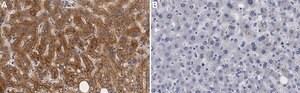 Anti-ABCA1 Antibody, clone 1J11 ZooMAb&#174; Rabbit Monoclonal recombinant, expressed in HEK 293 cells
