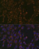 Anti-CLPP antibody produced in rabbit