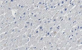 Anti-NDUFB8 Antibody, clone 1E7 ZooMAb&#174; Rabbit Monoclonal recombinant, expressed in HEK 293 cells