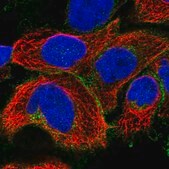 Anti-SLC19A1 antibody produced in rabbit Prestige Antibodies&#174; Powered by Atlas Antibodies, affinity isolated antibody, buffered aqueous glycerol solution