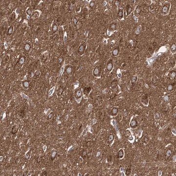 Anti-ADCY2 antibody produced in rabbit Prestige Antibodies&#174; Powered by Atlas Antibodies, affinity isolated antibody, buffered aqueous glycerol solution