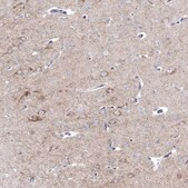 Anti-PDYN antibody produced in rabbit Prestige Antibodies&#174; Powered by Atlas Antibodies, affinity isolated antibody, buffered aqueous glycerol solution