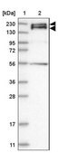 Anti-SYNJ2 antibody produced in rabbit Prestige Antibodies&#174; Powered by Atlas Antibodies, affinity isolated antibody, buffered aqueous glycerol solution
