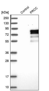 Anti-PRCC antibody produced in rabbit Prestige Antibodies&#174; Powered by Atlas Antibodies, affinity isolated antibody, buffered aqueous glycerol solution, Ab1