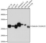 Anti-Galectin 3/LGALS3 antibody produced in rabbit