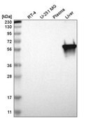 Anti-PKLR antibody produced in rabbit Prestige Antibodies&#174; Powered by Atlas Antibodies, affinity isolated antibody