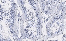 Anti-HSC70 Antibody, clone 1B15 ZooMAb&#174; Rabbit Monoclonal recombinant, expressed in HEK 293 cells