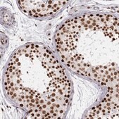 Monoclonal Anti-PARP1 antibody produced in mouse Prestige Antibodies&#174; Powered by Atlas Antibodies, clone CL2220, purified immunoglobulin, buffered aqueous glycerol solution