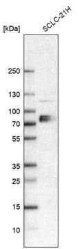 Anti-SLC7A1 antibody produced in rabbit affinity isolated antibody, buffered aqueous glycerol solution