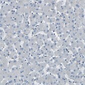 Anti-PDE9A antibody produced in rabbit Prestige Antibodies&#174; Powered by Atlas Antibodies, affinity isolated antibody, buffered aqueous glycerol solution