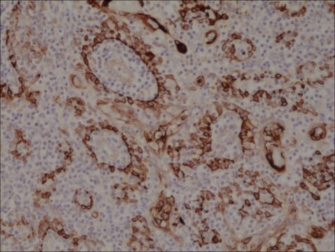 Anti-Cytokeratin 17 (CK-17) antibody, Rabbit monoclonal recombinant, expressed in HEK 293 cells, clone RM351, purified immunoglobulin