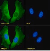 Anti-CAMK2A antibody produced in goat affinity isolated antibody, buffered aqueous solution