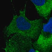 Anti-CBFB antibody produced in rabbit Prestige Antibodies&#174; Powered by Atlas Antibodies, affinity isolated antibody, buffered aqueous glycerol solution