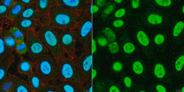 Anti-Nurr1 (NR4A2) from rabbit, purified by affinity chromatography