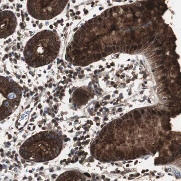 Anti-MUC1 antibody produced in rabbit Prestige Antibodies&#174; Powered by Atlas Antibodies, affinity isolated antibody, buffered aqueous glycerol solution