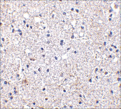 Anti-SCO1 antibody produced in rabbit affinity isolated antibody, buffered aqueous solution