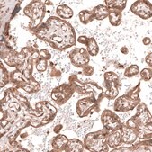 Anti-TRIM21 antibody produced in rabbit Prestige Antibodies&#174; Powered by Atlas Antibodies, affinity isolated antibody, buffered aqueous glycerol solution