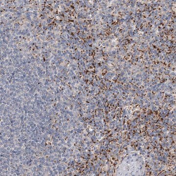 Anti-ALKBH8 antibody produced in rabbit Prestige Antibodies&#174; Powered by Atlas Antibodies, affinity isolated antibody, buffered aqueous glycerol solution