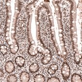 Anti-SETD2 antibody produced in rabbit Prestige Antibodies&#174; Powered by Atlas Antibodies, affinity isolated antibody, buffered aqueous glycerol solution