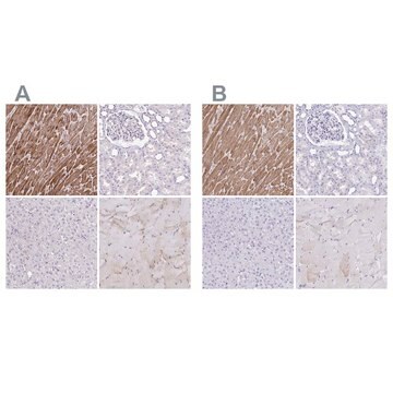 Anti-TNNT2 antibody produced in rabbit Prestige Antibodies&#174; Powered by Atlas Antibodies, affinity isolated antibody, buffered aqueous glycerol solution