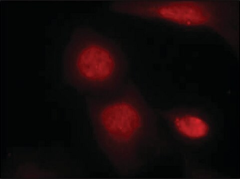Anti-phospho-AR (pSer213) antibody produced in rabbit affinity isolated antibody