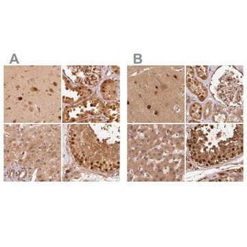 Anti-PSMD1 antibody produced in rabbit Prestige Antibodies&#174; Powered by Atlas Antibodies, affinity isolated antibody, buffered aqueous glycerol solution