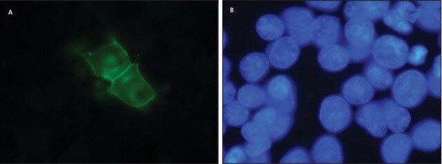 Anti-D1 Dopamine Receptor antibody,Rat monoclonal clone 1-1-F11 s.E6, purified from hybridoma cell culture