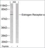 Anti-ESR1 (Ab-104) antibody produced in rabbit affinity isolated antibody