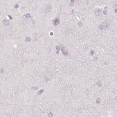 Anti-CSN1S1 antibody produced in rabbit Prestige Antibodies&#174; Powered by Atlas Antibodies, affinity isolated antibody