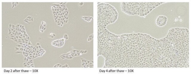 Canine MDR1 Knockout, Human MDR1 Knockin MDCKII Cells