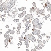 Anti-FN1 antibody produced in rabbit Prestige Antibodies&#174; Powered by Atlas Antibodies, affinity isolated antibody, buffered aqueous glycerol solution