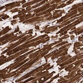 Monoclonal Anti-MYH6 antibody produced in mouse Prestige Antibodies&#174; Powered by Atlas Antibodies, clone CL2162, purified immunoglobulin, buffered aqueous glycerol solution