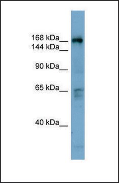 Anti-DOCK2 antibody produced in rabbit affinity isolated antibody