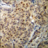 Anti-phospho-Akt1 (pThr450) antibody produced in rabbit affinity isolated antibody