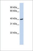 Anti-FGG antibody produced in rabbit affinity isolated antibody