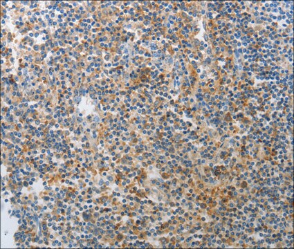 Anti-AD7C-NTP antibody produced in rabbit affinity isolated antibody