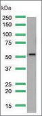Anti-PTEN antibody, Rabbit monoclonal clone SP218, recombinant, expressed in proprietary host, affinity isolated antibody