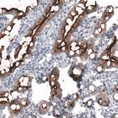 Monoclonal Anti-ACE2 antibody produced in mouse Prestige Antibodies&#174; Powered by Atlas Antibodies, clone CL4013, purified immunoglobulin