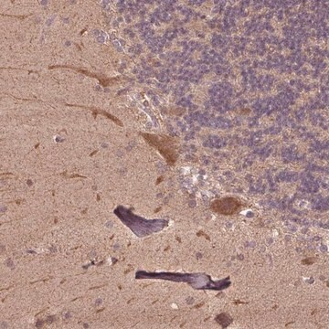 Anti-CUTA antibody produced in rabbit Prestige Antibodies&#174; Powered by Atlas Antibodies, affinity isolated antibody, buffered aqueous glycerol solution