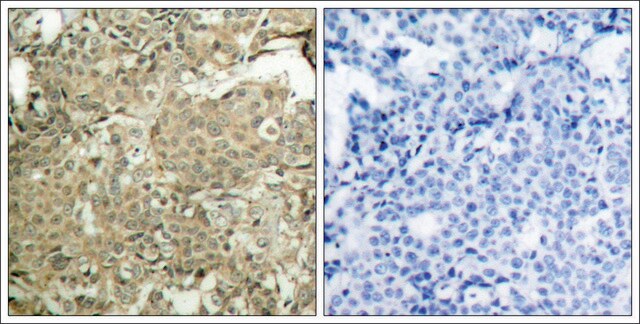 Anti-phospho-CFL1 (pSer3) antibody produced in rabbit affinity isolated antibody