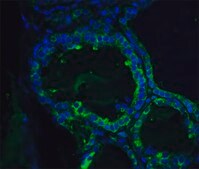 Anti-ORAI1 antibody produced in rabbit affinity isolated antibody, buffered aqueous solution
