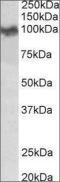 Anti-App (N-terminal) antibody produced in goat affinity isolated antibody, buffered aqueous solution