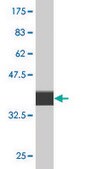 Monoclonal Anti-CLIC5 antibody produced in mouse clone 1E6, purified immunoglobulin, buffered aqueous solution